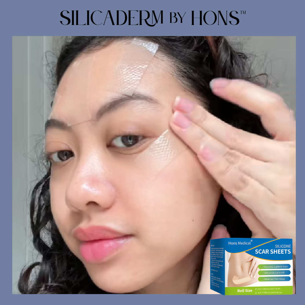 SilicaDerm by Hons™ Medical Silicone Scar Sheets
