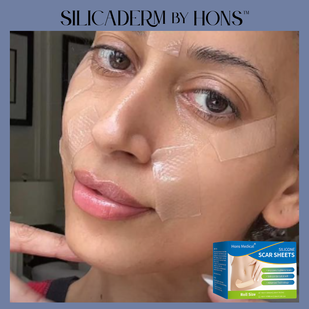 SilicaDerm by Hons™ Medical Silicone Scar Sheets
